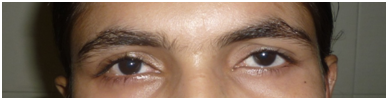 Oculoplasty Doctor in Rajasthan